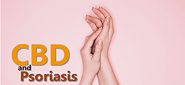 CBD and psoriasis hands.